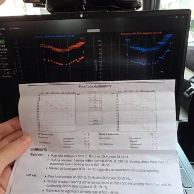 聽力測試圖對比